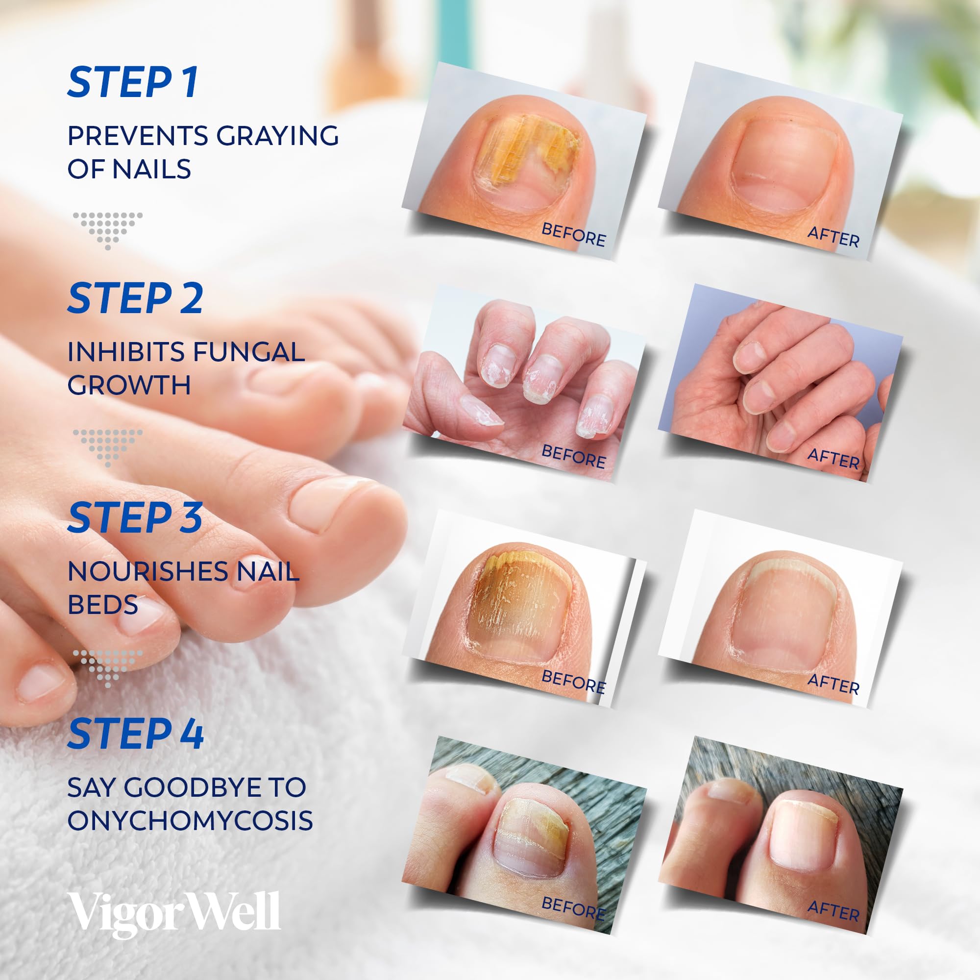 Aplicación de 8 horas para reparación nocturna de uñas.