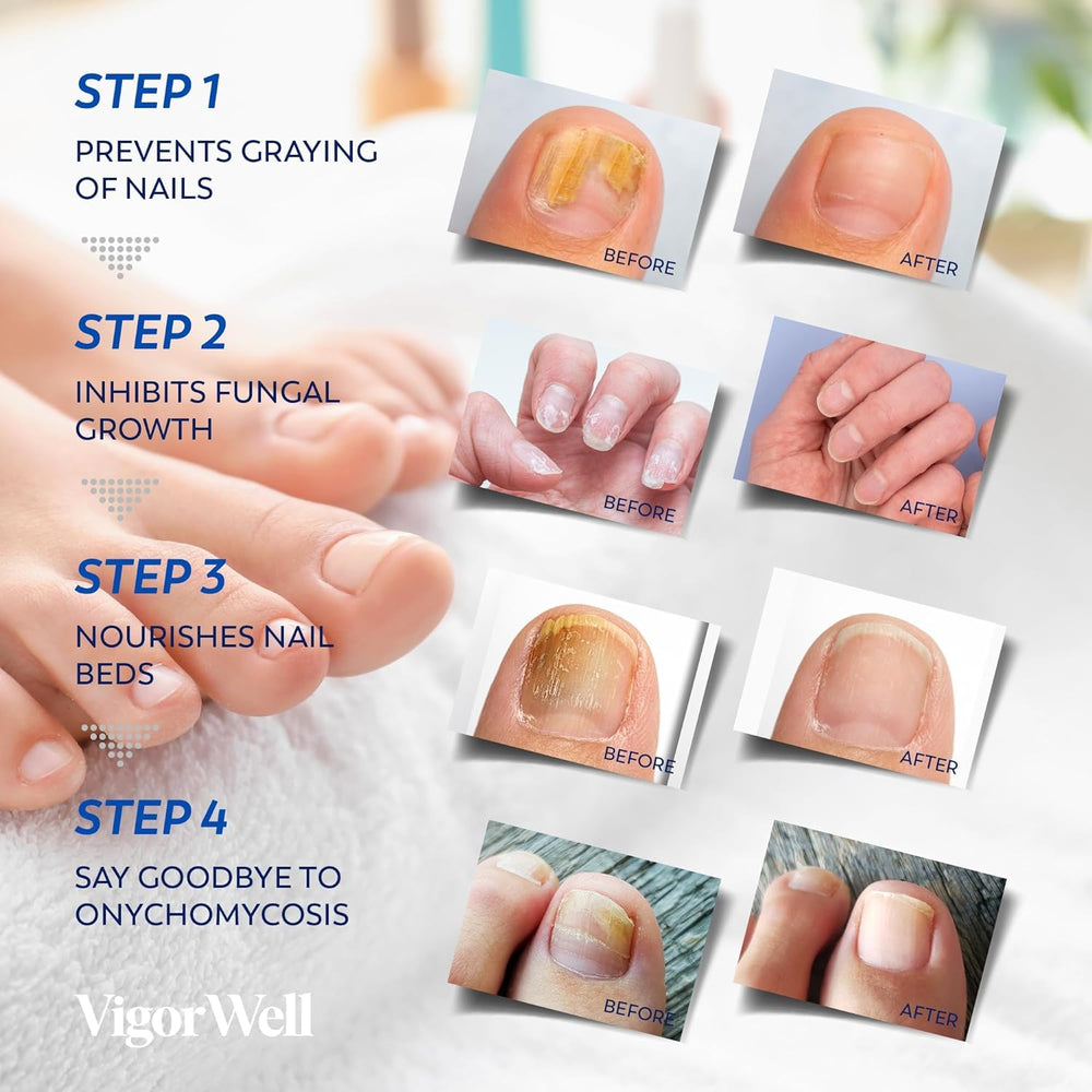 Embalaje VigorWell 21 Piezas, kit completo para mantenimiento regular de uñas.