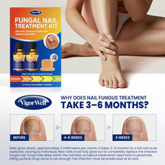 Parche de uñas hidrogel VigorWell, textura suave y reparadora.