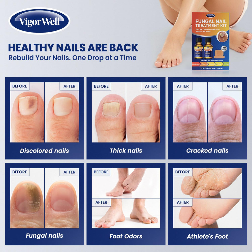 Parches de reparación de uñas VigorWell, diseño tono piel para uso discreto.