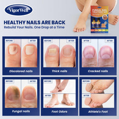 Parches de reparación de uñas VigorWell, diseño tono piel para uso discreto.