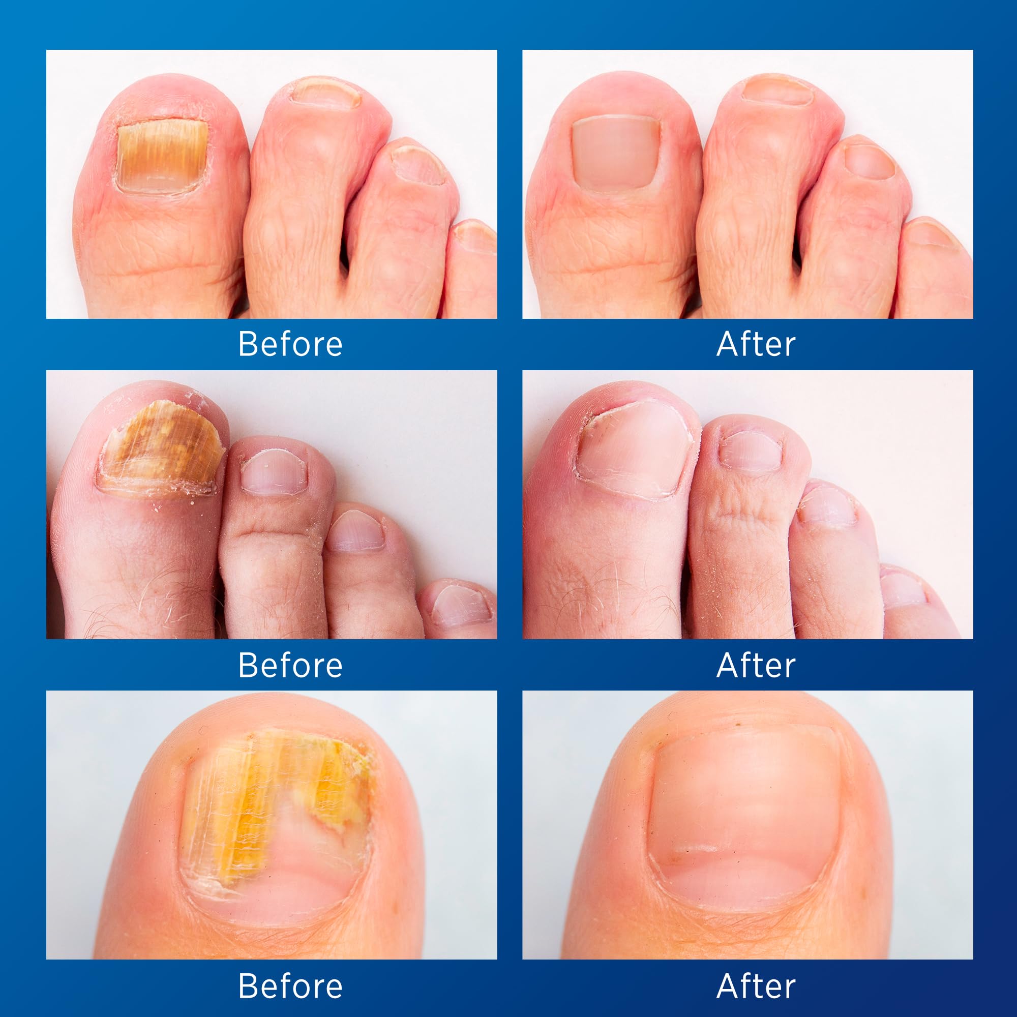 Tecnología Hidrogel de VigorWell para fortalecimiento de uñas con mayor adherencia.