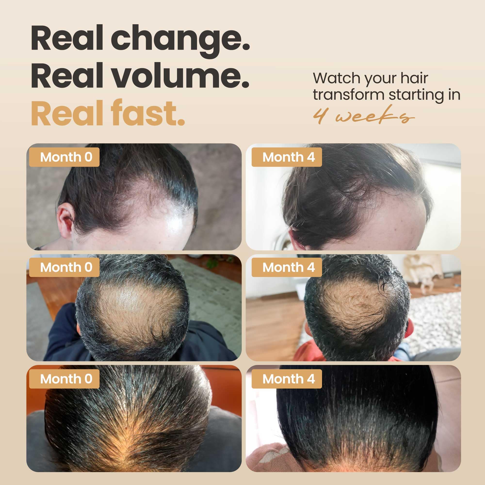 Vitasei Impulsor de Cabello: capilia longa para fortalecer raíces y folículos.