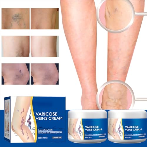 Wanban crema alivio rápido para piernas cansadas; absorción ligera y no grasa