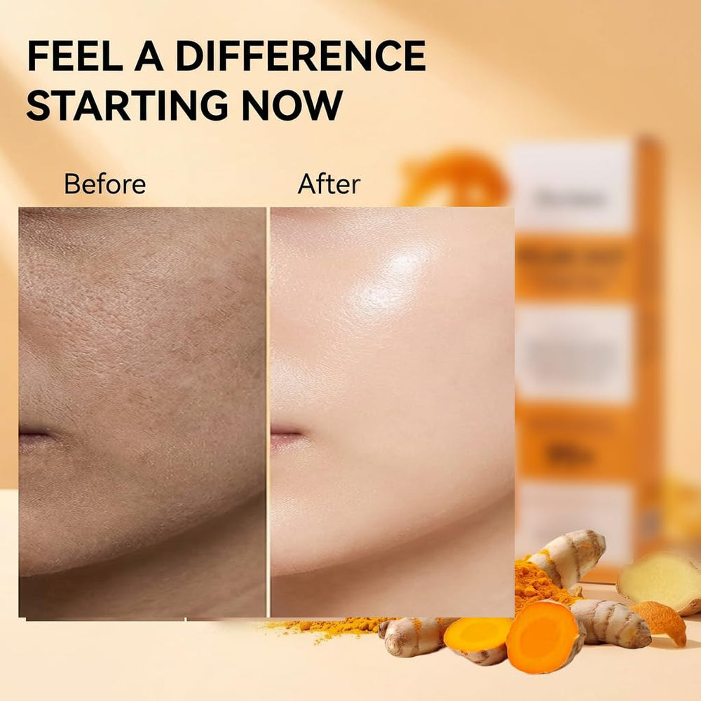WBFK spray exfoliante de cúrcuma para el cuerpo: mejora la textura de la piel