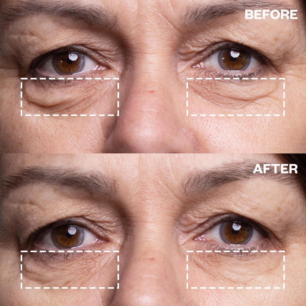Wrinkles Schminkles aplicación nocturna para ojos, diseño transparente cómodo para dormir.