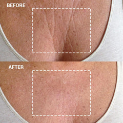 Parche Wrinkles Schminkles de silicona adherido, textura suave para uso nocturno.