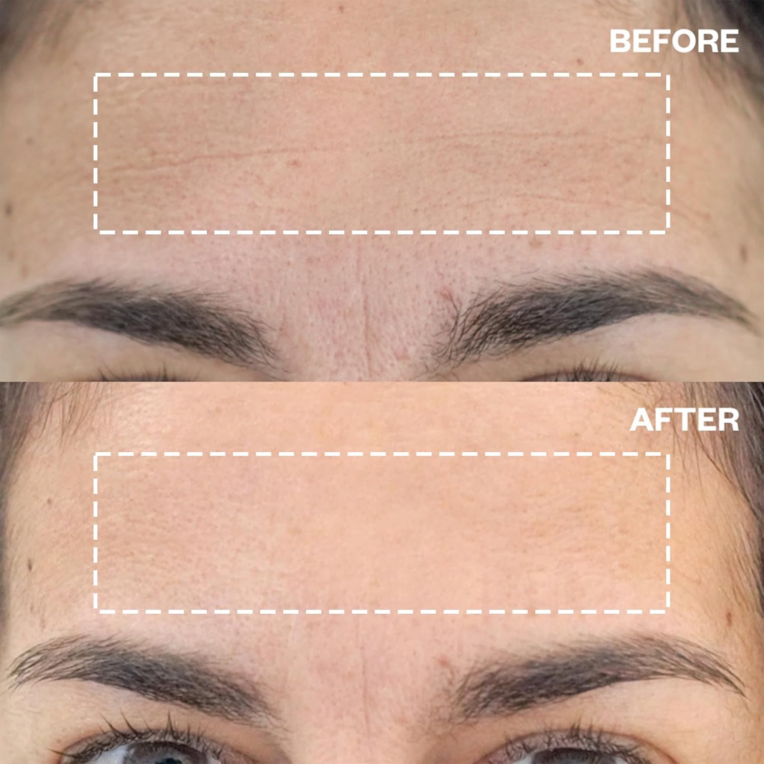 Parches Wrinkles Schminkles para uso nocturno en la frente, cuidado suave.