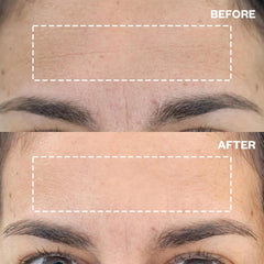 Parches Wrinkles Schminkles para uso nocturno en la frente, cuidado suave.