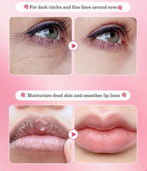 Parche labial YMEYFAN rosa para labios hidratados y suaves