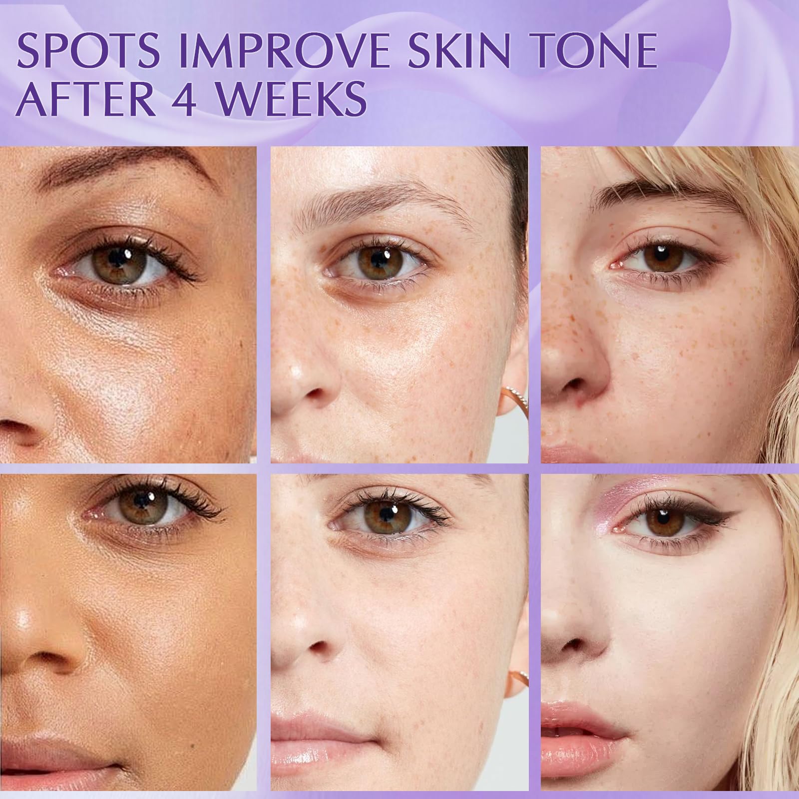 YRNVK Tratamiento de melasma con mejoras visibles