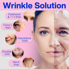 Zancony cinta facial para nasolabiales, reduce surcos y define contorno.