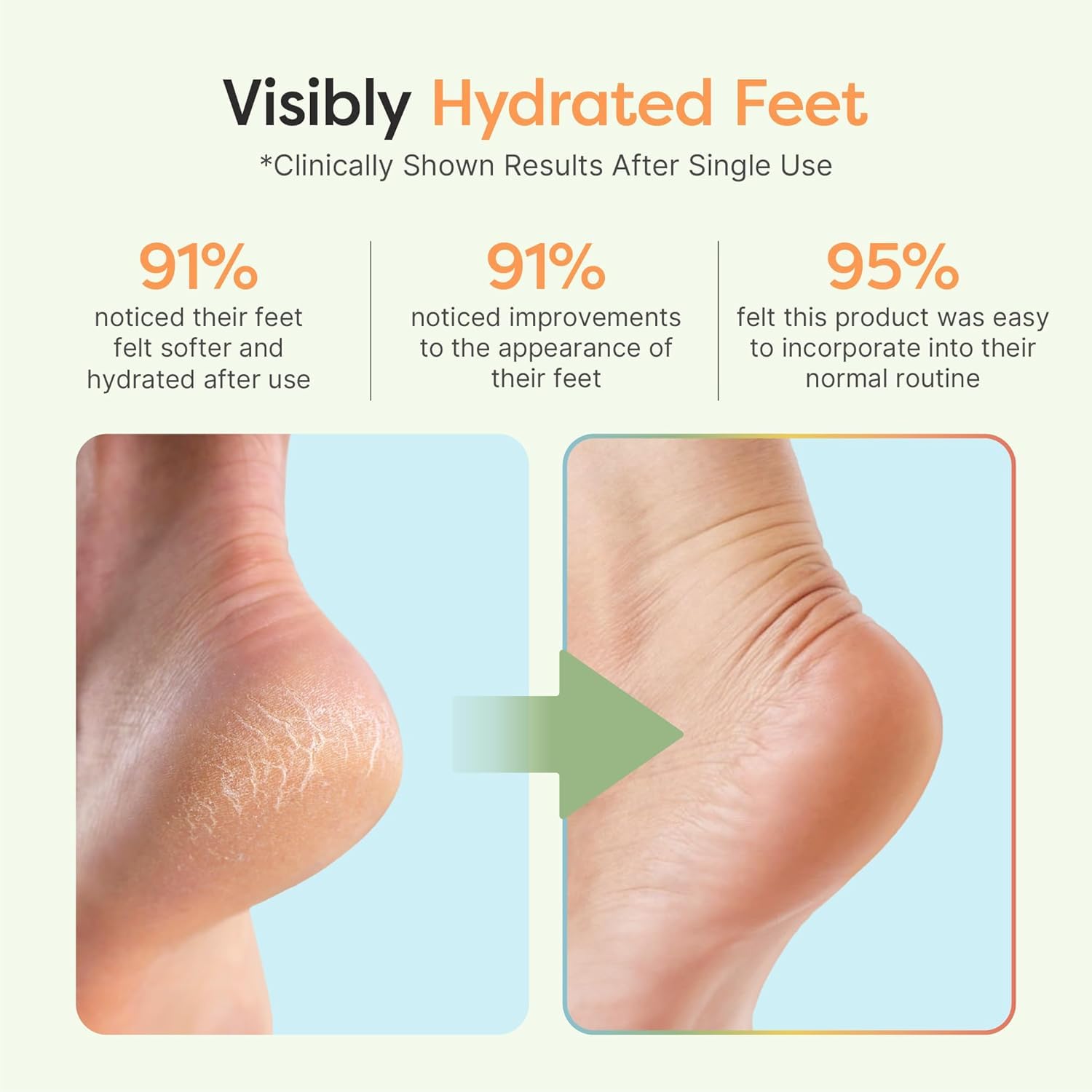 ZenToes talones infusionados con jojoba, oliva y vitamina E para hidratación